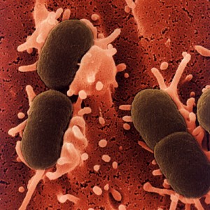 These Escherichia coli bacteria (commonly known as E. coli) are native to your lower digestive tract. It's when they get in your stomach via food that they become a problem. But keeping them happy in your lower intestine will keep you happy!